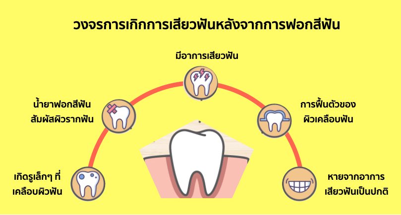 วงจรการเกิดอาการเสียวฟันหลังจากฟอกสีฟัน ซึ่งป้องกันได้