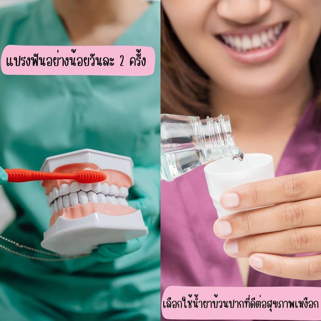 ฟันล่างคร่อมฟันบน สามารถจัดฟันโดยไม่ผ่าตัดได้หรือไม่