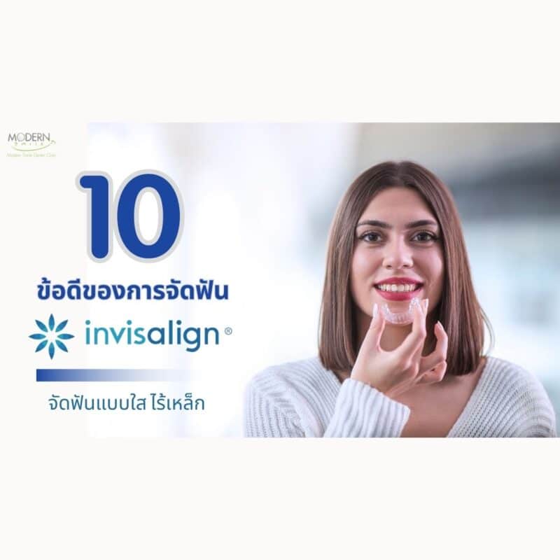 10 ข้อดีของการจัดฟันใส Invisalign